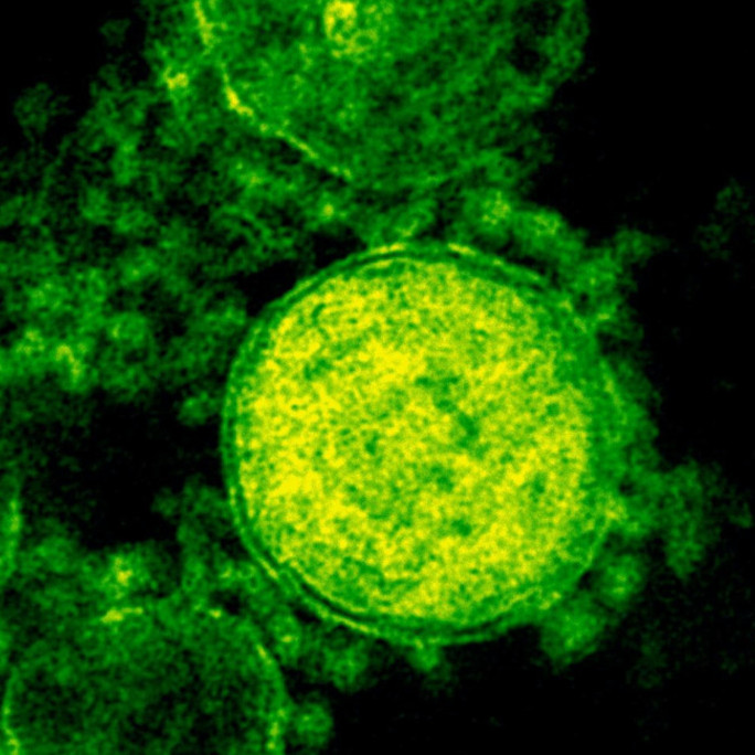 Live-Vorführung: Infection